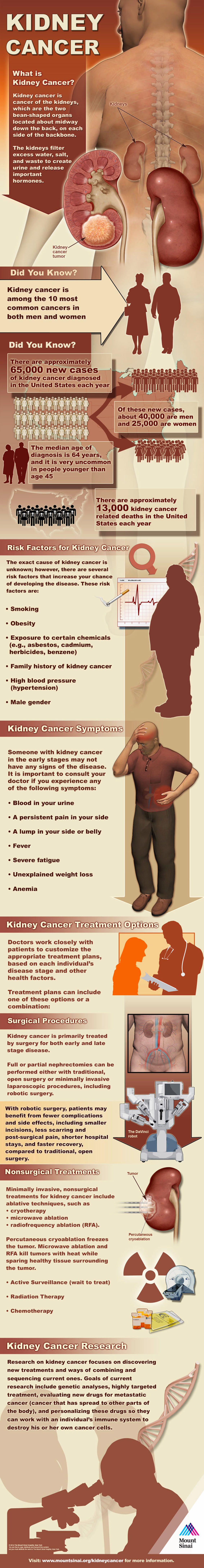 Kidney Cancer Symptoms and Treatment - Health Infographic