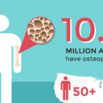 Should You Take a Bone Density Test to Diagnose Osteoporosis?